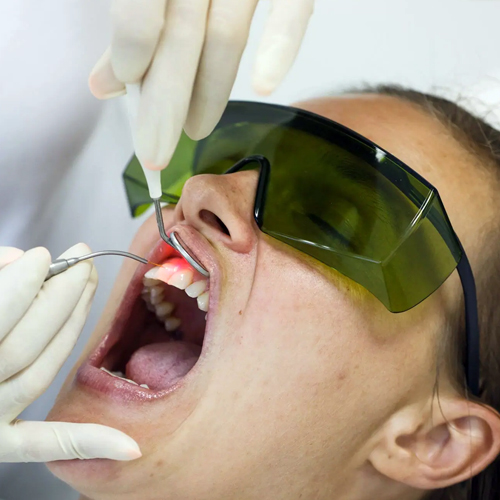 Gum Disease Laser Specialist